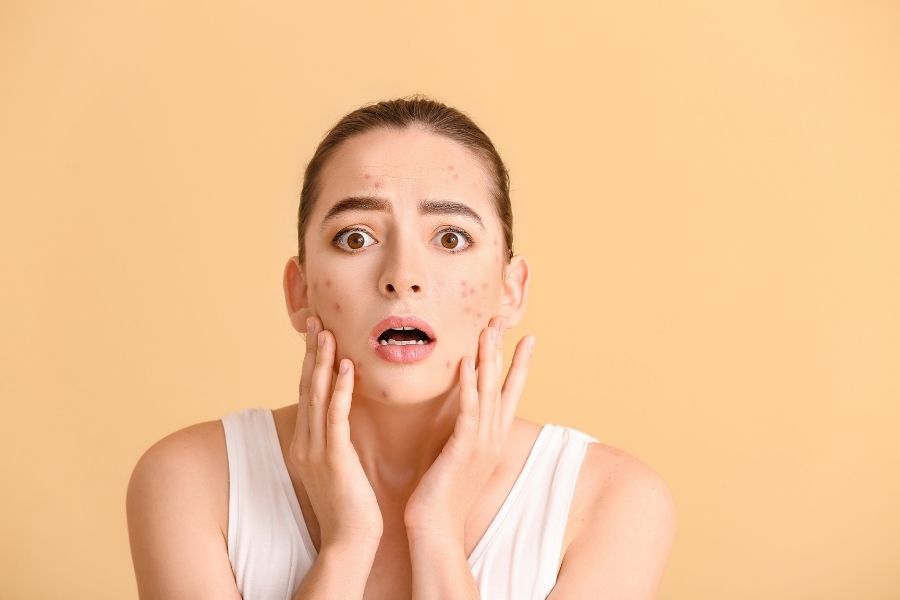 לחץ ועור הפנים פרומיס